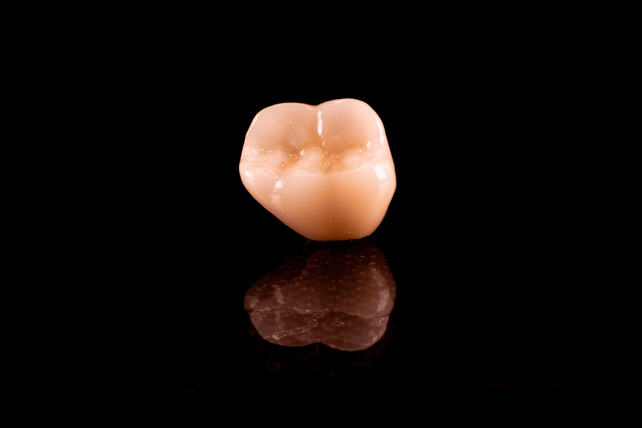 DSC00998 https://checkdent.cl/wp-content/uploads/2025/01/DSC00998-1280x853.png